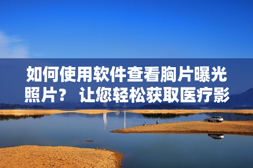 如何使用軟件查看胸片曝光照片？ 讓您輕松獲取醫(yī)療影像結(jié)果